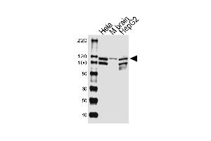 Western blot analysis of lysates from Hela cell line, mouse brain tissue lysate, HepG2 cell line (from left to right), using UBE3CAntibody (Center) (ABIN1881969 and ABIN2843383). (UBE3C 抗体  (AA 549-578))