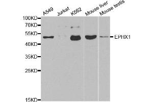 Western blot analysis of extracts of various cell lines, using EPHX1 antibody. (EPHX1 抗体)