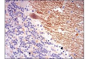 Immunohistochemistry (IHC) image for anti-gamma-aminobutyric Acid (GABA) B Receptor, 2 (GABBR2) (AA 319-483) antibody (ABIN1724937)