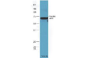 Mouse brain lysates probed (ABIN744788) at 1:300 overnight in 4 °C. (EIF2AK2 抗体  (pThr446))