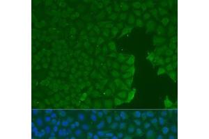 Immunofluorescence analysis of U2OS cells using CD31 Polyclonal Antibody at dilution of 1:100. (CD31 抗体)