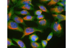 HeLa cell cultures stained with ABIN1580461 (green) and ’s chicken polyclonal antibody to vimentin: CPCA-Vim (red). (Ubiquilin 2 抗体)