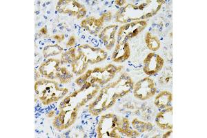 Immunohistochemistry of paraffin-embedded rat kidney using SIRT3 antibody (ABIN2559929) at dilution of 1:100 (40x lens). (SIRT3 抗体)