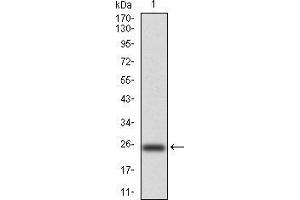 Western blot analysis using NOX4 mAb against human NOX4 (AA: 210-310) recombinant protein. (NADPH Oxidase 4 抗体  (AA 210-310))