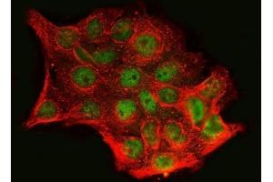 IF analysis of SnoN/SNO/SKIL using anti-SnoN/SNO/SKIL antibody (ABIN7599455).