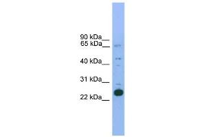WB Suggested Anti-Nkx2-6 Antibody Titration: 0. (NKX2-6 抗体  (N-Term))