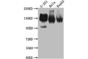 Western Blot Positive WB detected in: U-251 whole cell lysate, Hela whole cell lysate, HepG2 whole cell lysate All lanes: ITGAV antibody at 1:1000 Secondary Goat polyclonal to rabbit IgG at 1/50000 dilution Predicted band size: 117, 113, 112 kDa Observed band size: 130 kDa (Recombinant CD51 抗体)