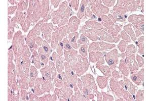 Human Heart (formalin-fixed, paraffin-embedded) stained with ARHGEF17 antibody LAP22665PU-N at 5 µg/ml followed by biotinylated goat anti-rabbit IgG secondary antibody, alkaline phosphatase-streptavidin and chromogen. (ARHGEF17 抗体)