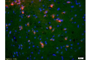 Formalin-fixed and paraffin-embedded rat brain labeled with Anti-EphA5/Eph receptor A5 Polyclonal Antibody, Unconjugated (ABIN718661) 1:200, overnight at 4°C, The secondary antibody was Goat Anti-Rabbit IgG, Cy3 conjugated used at 1:200 dilution for 40 minutes at 37°C.