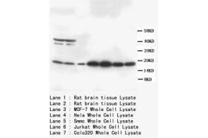 Image no. 1 for anti-S100 Calcium Binding Protein B (S100B) (C-Term) antibody (ABIN1493108) (S100B 抗体  (C-Term))