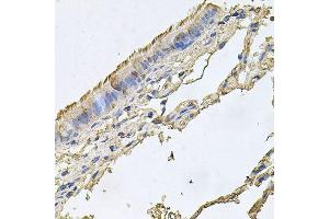 Immunohistochemistry of paraffin-embedded human trachea using FABP12 antibody (ABIN6003626) at dilution of 1/100 (40x lens). (FABP12 抗体)