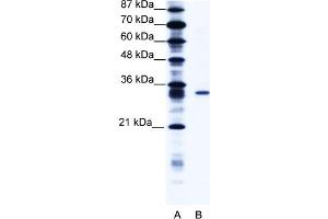 WB Suggested Anti-KCNIP4 Antibody   Titration: 1. (KCNIP4 抗体  (N-Term))