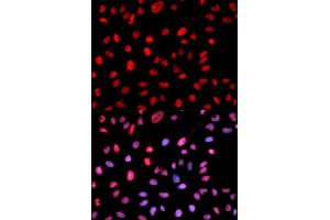 Immunofluorescence analysis of MCF7 cell using Phospho-Dnmt1-pS714 antibody. (DNMT1 抗体  (pSer714))