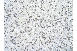 Rabbit Anti-TRA2B Antibody       Paraffin Embedded Tissue:  Human cardiac cell   Cellular Data:  Epithelial cells of renal tubule  Antibody Concentration:   4.