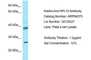 Western Blotting (WB) image for anti-Ribosomal Protein L10 (RPL10) (N-Term) antibody (ABIN2789820) (RPL10 抗体  (N-Term))