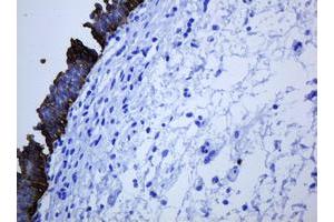 Image no. 5 for anti-Keratin 5 (KRT5) (AA 1-273) antibody (ABIN1490696) (Cytokeratin 5 抗体  (AA 1-273))