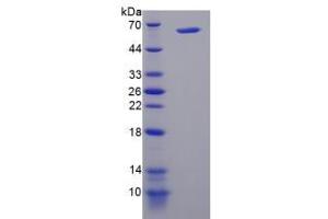 Image no. 1 for Phosphatidylinositol 4-Kinase, Catalytic, alpha (PI4KA) (AA 1-300) protein (His tag,GST tag) (ABIN6238602)