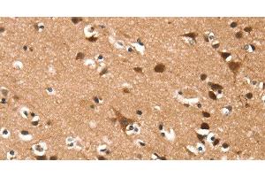 Immunohistochemistry of paraffin-embedded Human brain using DAAM1 Polyclonal Antibody at dilution of 1:50 (DAAM1 抗体)