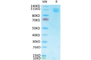SDS-PAGE (SDS) image for SARS-CoV-2 Spike S1 protein (His-Avi Tag,Biotin) (ABIN7275551)