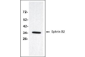 Antigen: Colo 205 cells lysate (Total protein per lane: 20 µg)  Primary Antibody: Anti-EFNB2 monoclonal (PA349-18. (Ephrin B2 抗体  (Extracellular Domain))