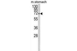 Western Blotting (WB) image for anti-Transcription Elongation Regulator 1-Like (TCERG1L) antibody (ABIN3003948) (TCERG1L 抗体)