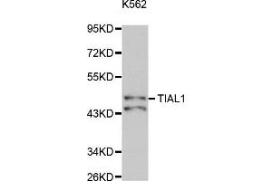 Western Blotting (WB) image for anti-TIA1 Cytotoxic Granule-Associated RNA Binding Protein-Like 1 (TIAL1) antibody (ABIN1877102) (TIAL1 抗体)