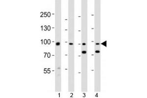 Western blot analysis of lysate from 1) human A431, 2) mouse NIH3T3 cell line, 3) mouse brain and 4) rat brain tissue lysate using Ephb1 antibody at 1:1000. (EPH Receptor B1 抗体  (AA 374-409))