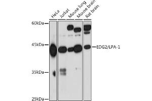 Western blot analysis of extracts of various cell lines, using EDG2/LPA-1 Rabbit mAb (ABIN7268334) at 1:1000 dilution. (LPAR1 抗体)