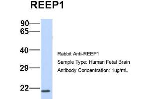 Host:  Rabbit  Target Name:  REEP1  Sample Type:  Human Fetal Brain  Antibody Dilution:  1. (Receptor Accessory Protein 1 抗体  (C-Term))