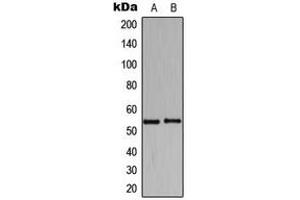 Western blot analysis of HARS expression in K562 (A), Raw264. (HARS1/Jo-1 抗体  (C-Term))