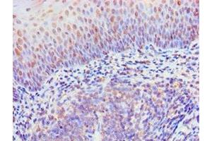 Immunohistochemistry of paraffin-embedded human tonsil tissue using ABIN7167479 at dilution of 1:100 (RIPK3 抗体  (AA 1-120))