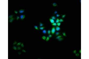 Immunofluorescence staining of PC-3 cells with ABIN7165742 at 1:16, counter-stained with DAPI. (LIX1 抗体  (AA 1-282))