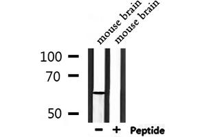 Western blot analysis of extracts from mouse brain, using Phospho-PAK1 (Thr212) Antibody. (PAK1 抗体  (pThr212))