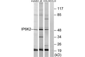 Western Blotting (WB) image for anti-Inositol Hexakisphosphate Kinase 2 (IP6K2) (Internal Region) antibody (ABIN1850058) (IP6K2 抗体  (Internal Region))