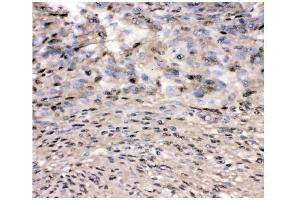 IHC analysis of VCP using anti-VCP antibody (ABIN3043958).