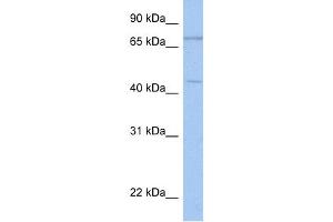 WB Suggested Anti-ISLR2 Antibody Titration:  0. (ISLR2 抗体  (N-Term))