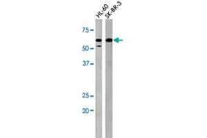 The PKMYT1 (phospho T495) polyclonal antibody  is used in Western blot to detect Phospho-PKMYT1-T495 in HL-60 (left) and SK-BR-3 (right) cell lysates