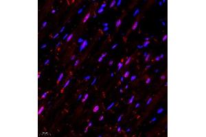 Immunofluorescence (Paraffin-embedded Sections) (IF (p)) image for anti-Wolf-Hirschhorn Syndrome Candidate 1-Like 1 (WHSC1L1) antibody (ABIN7076233)