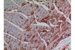 Immunohistochemistry (IHC) image for anti-Cyclin-Dependent Kinase 4 (CDK4) (N-Term) antibody (ABIN3187734)
