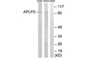 Western blot analysis of extracts from RAW264. (APLP2 抗体  (AA 241-290))