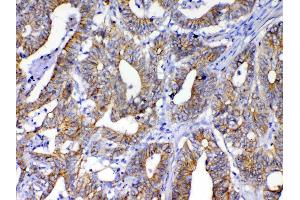 Immunohistochemistry (IHC) image for anti-Catenin (Cadherin-Associated Protein), beta 1, 88kDa (CTNNB1) (AA 2-233) antibody (ABIN5518980)