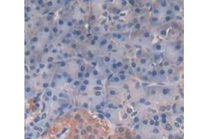 IHC-P analysis of Human Tissue, with DAB staining. (TPSG1 抗体  (AA 99-244))