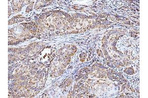 IHC analysis of Integrin linked ILK using anti-Integrin linked ILK antibody (ABIN7602632). (ILK 抗体  (AA 9-452))