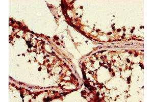 Immunohistochemistry of paraffin-embedded human testis tissue using ABIN7155852 at dilution of 1:100 (TGIF1 抗体  (AA 8-375))