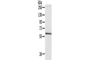 Gel: 8 % SDS-PAGE, Lysate: 40 μg, Lane: Human fetal brain tissue, Primary antibody: ABIN7190498(DPYSL5 Antibody) at dilution 1/250, Secondary antibody: Goat anti rabbit IgG at 1/8000 dilution, Exposure time: 30 seconds (DPYSL5 抗体)