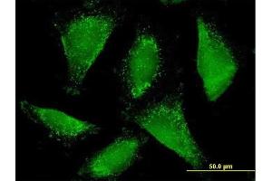 Immunofluorescence of purified MaxPab antibody to ACAA1 on HepG2 cell. (ACAA1 抗体  (AA 1-424))
