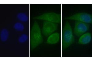 Detection of CALR in Human MCF7 cell using Polyclonal Antibody to Calreticulin (CALR) (Calreticulin 抗体  (AA 18-193))