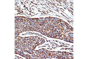 Immunohistochemistry (IHC) image for anti-NADH Dehydrogenase (Ubiquinone) 1 beta Subcomplex, 8, 19kDa (NDUFB8) antibody (ABIN7268813)