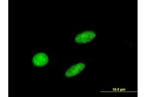 Immunofluorescence of monoclonal antibody to GCM1 on HeLa cell. (GCM1 抗体  (AA 108-166))