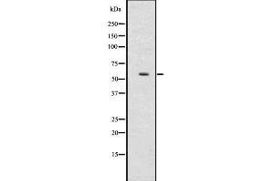 Western blot analysis of UGT2B using HepG2 whole  lysates. (UGT2B17 抗体  (N-Term))